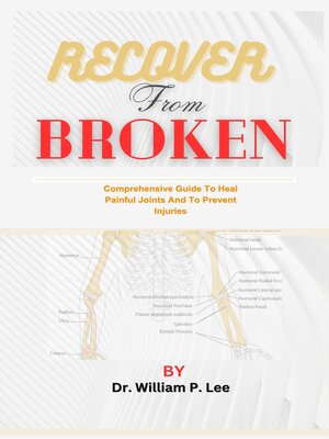 cover image of Recover from Broken